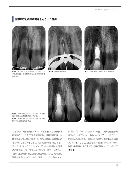 検証MTA