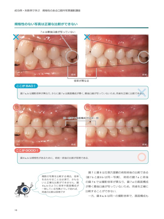 成功例・失敗例で学ぶ 規格性のある口腔内写真撮影講座