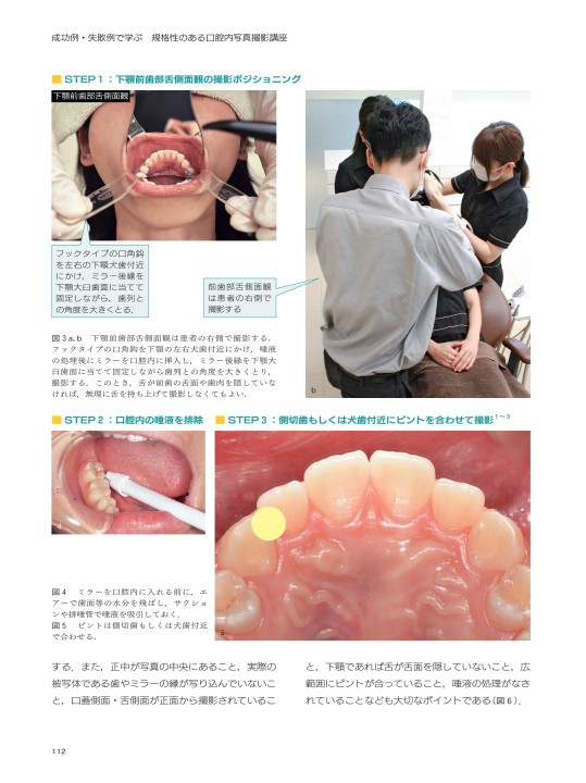 成功例・失敗例で学ぶ 企画性のある口腔内写真撮影口座