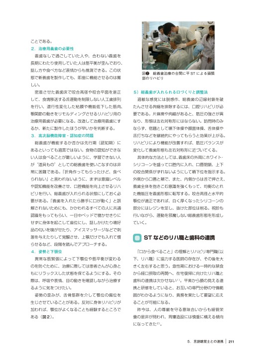 食べる喜びを支える歯科医療のためのデンチャースペース義歯 食べる喜びを支える歯科医療のためのデンチャースペース義歯