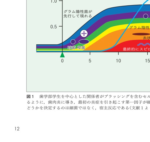 GPとDHのためのぺリオドントロジー2