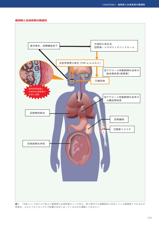 GPとDHのためのぺリオドントロジー2