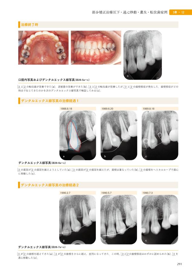 2024人気No.1の 全顎矯正と部分矯正へのアプローチ 健康+医学