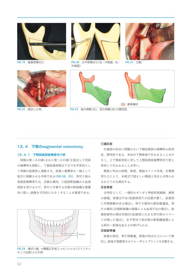 顎矯正手術エッセンシャル 顎矯正手術エッセンシャル | 相川 友直, 竹信 俊彦, 茶谷 仁史