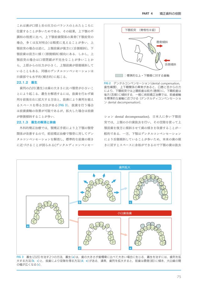顎変形症治療の基礎知識