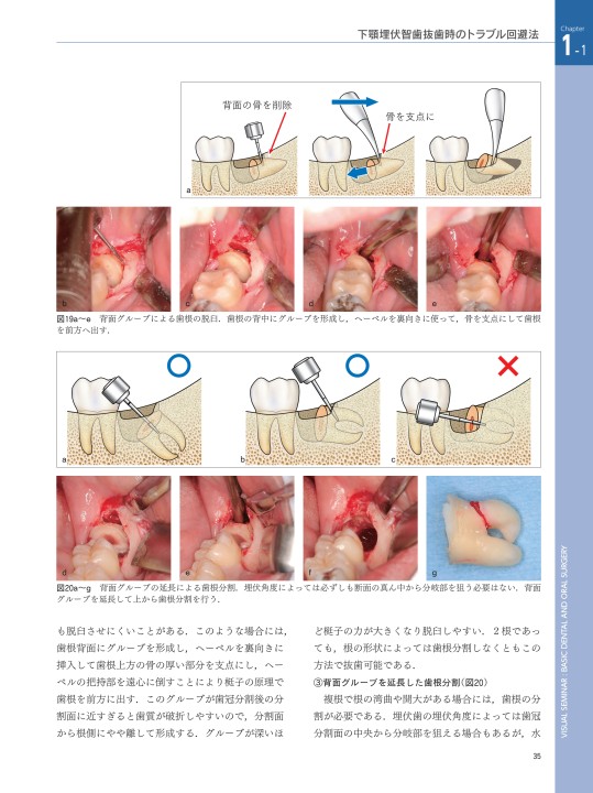 口腔外科専門医マニュアル 口腔外科専門医マニュアル/医歯薬出版株式会社