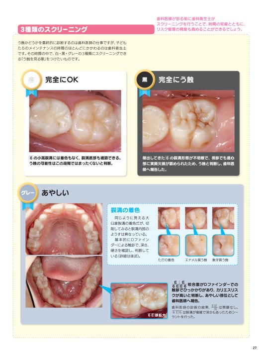 子どもたちの歯と歯列の成長を守るメインテナンス術