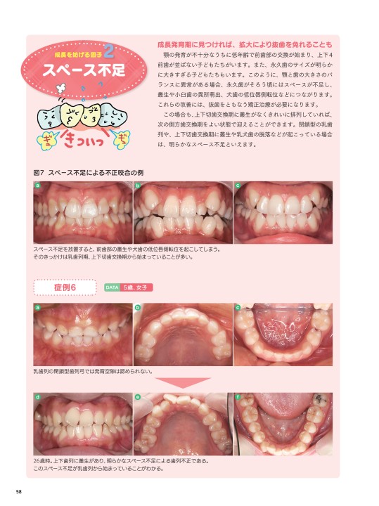 子どもたちの歯と歯列の成長を守るメインテナンス術 ゆるやかな指導で結果を出せる… 子どもたちの歯と歯列の成長を守るメインテナンス術 | 須貝 昭弘