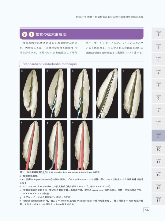 エンドに必要なアナトミー　根管の構造と機能に基づく実践歯内治療 / 川崎　孝一　著 トゥルーナトミーソリューション | デンツプライシロナ 日本