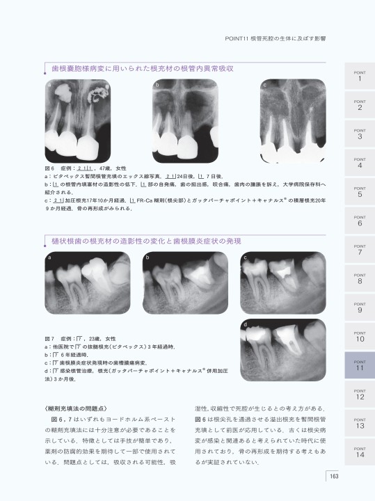 エンドに必要なアナトミー　根管の構造と機能に基づく実践歯内治療 / 川崎　孝一　著 トゥルーナトミーソリューション | デンツプライシロナ 日本