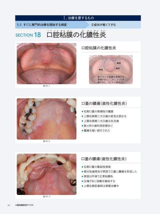 新版 チェアサイド・介護で役立つ 口腔粘膜疾患アトラス