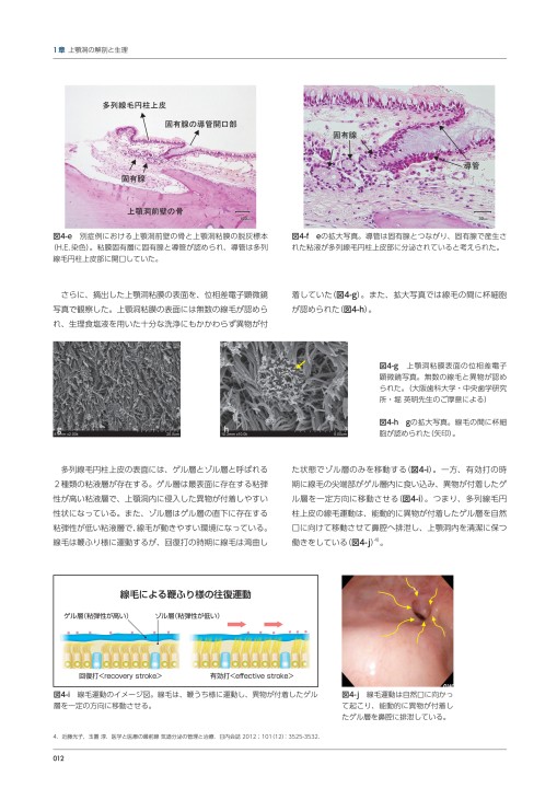 【裁断済】【即日発送】CTと動画が語る サイナスフロアエレベーションの真実 シエン社 | サイナスフロアエレベーションアルティメットガイド