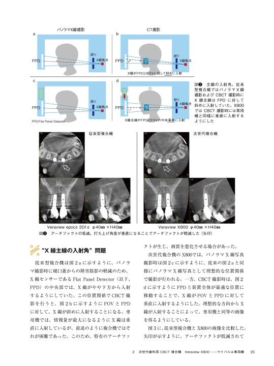 器材・薬剤からみる歯内療法のすぐれモノ