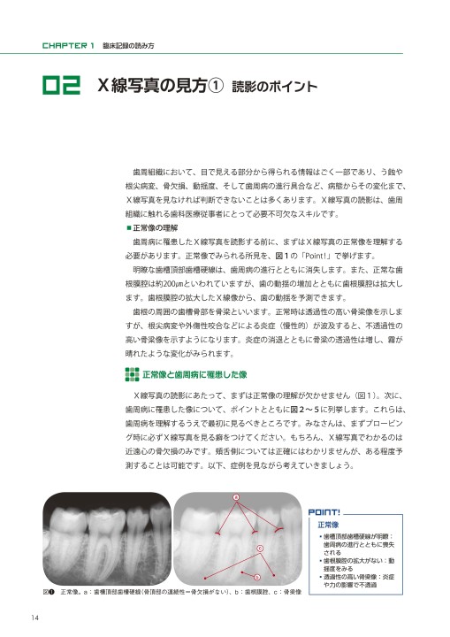 Amazon.co.jp: 歯周基本治療のレベルアップPOINT: 臨床記録の