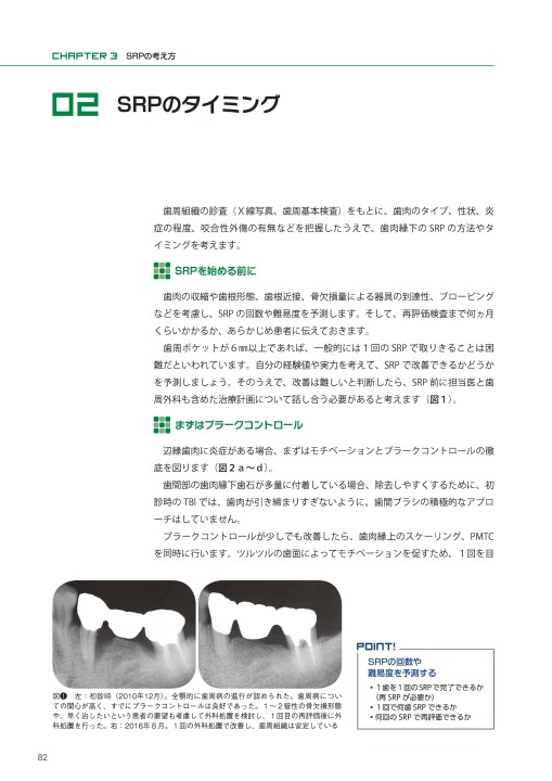 Amazon.co.jp: 歯周基本治療のレベルアップPOINT: 臨床記録の