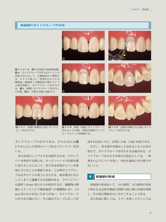 これならわかる 少ないバーでできる生活史の支台歯形成法