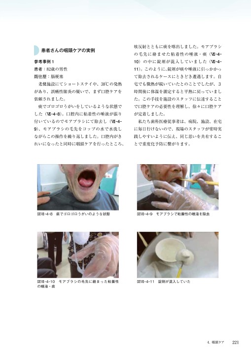 解剖から学ぶ口腔ケア・口腔リハビリの手技と、その実力