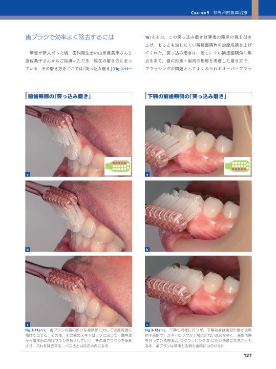 Amazon.com: ペリオドントロジー&ペリオドンティクス 上巻