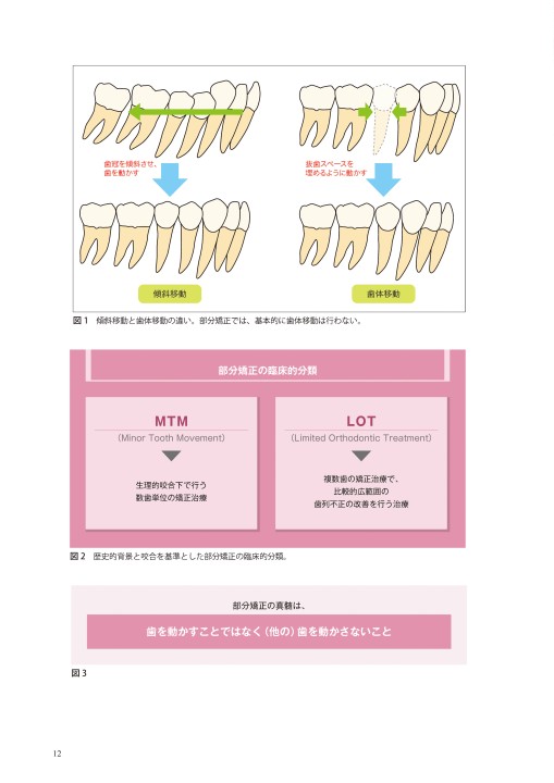 部分矯正 その臨床応用のすべて
