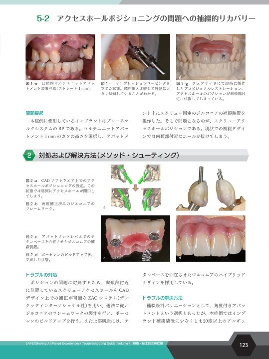 SAFE Troubleshooting Guide Volume 3 外科的合併症編 | 野阪