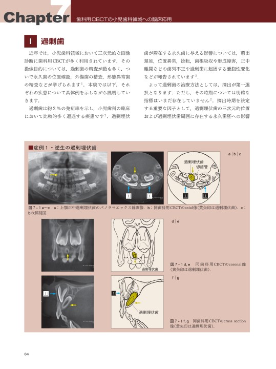 決定版 実践マニュアル歯科用CTの見かた・読みかた