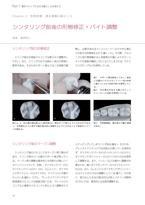 ジルコニアモノリシックレストレーションコンプリートブック