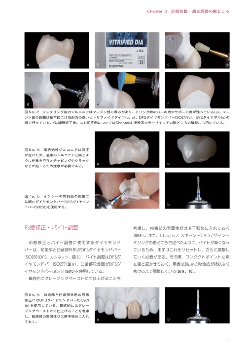 ジルコニアモノリシックレストレーションコンプリートブック