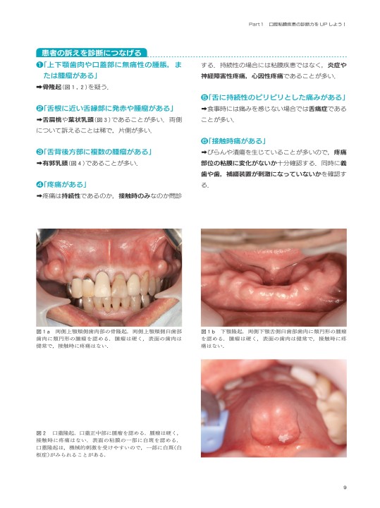 臨床で遭遇する口腔粘膜疾患に強くなる本