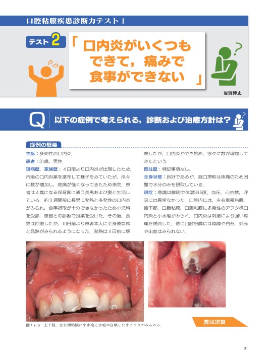 Amazon.co.jp: 口腔粘膜病変アトラス: 口の中をのぞいてみよう