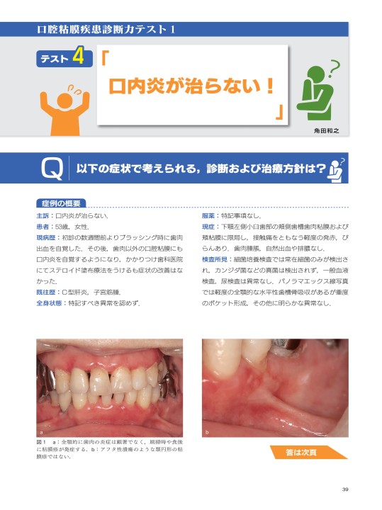 臨床で遭遇する口腔粘膜疾患に強くなる本