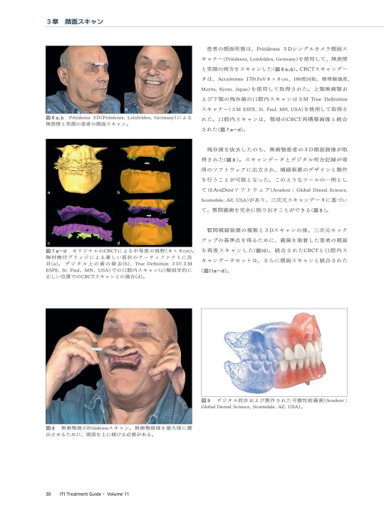 ITI Treatment Guide Vol11