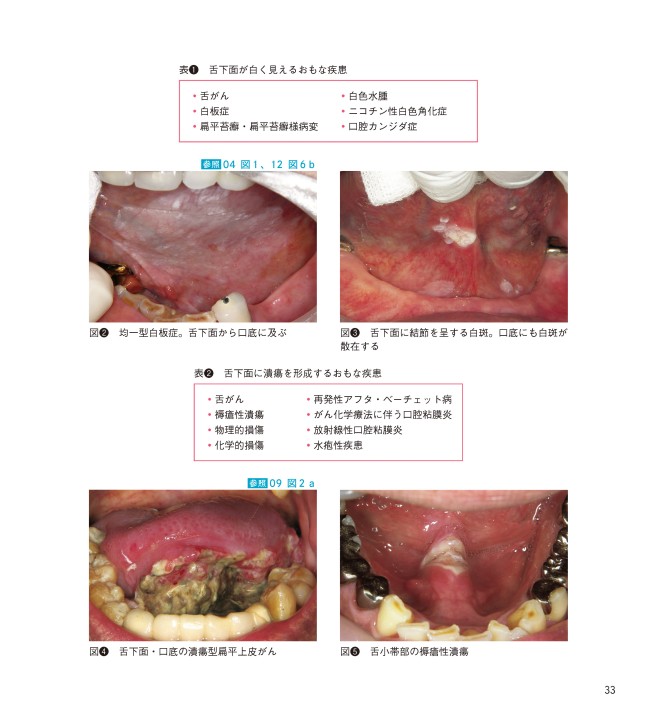 ビジュアルでわかる！口腔粘膜疾患の観察POINT