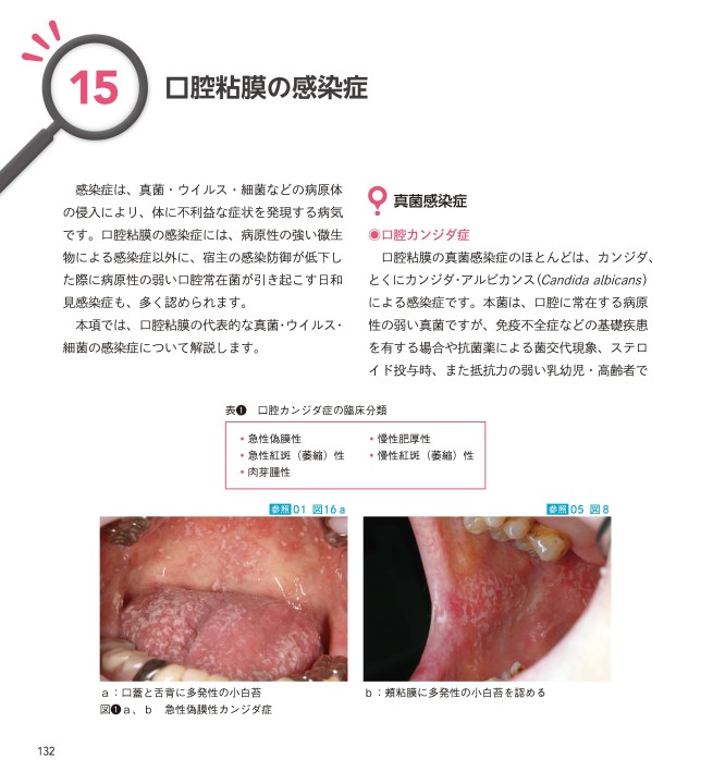 口腔粘膜・皮膚症状から「見抜く」全身疾患 オラドローム、デルマドローム Amazon.co.jp: 口腔粘膜・皮膚症状から「見抜く」全身疾患