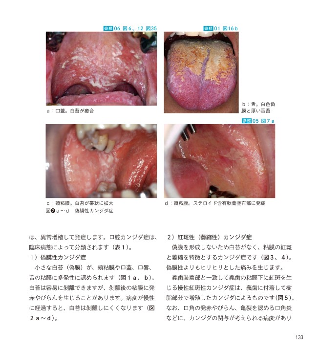 口腔粘膜・皮膚症状から「見抜く」全身疾患 オラドローム、デルマドローム Amazon.co.jp: 口腔粘膜・皮膚症状から「見抜く」全身疾患