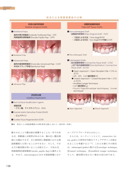 新時代の歯周外科