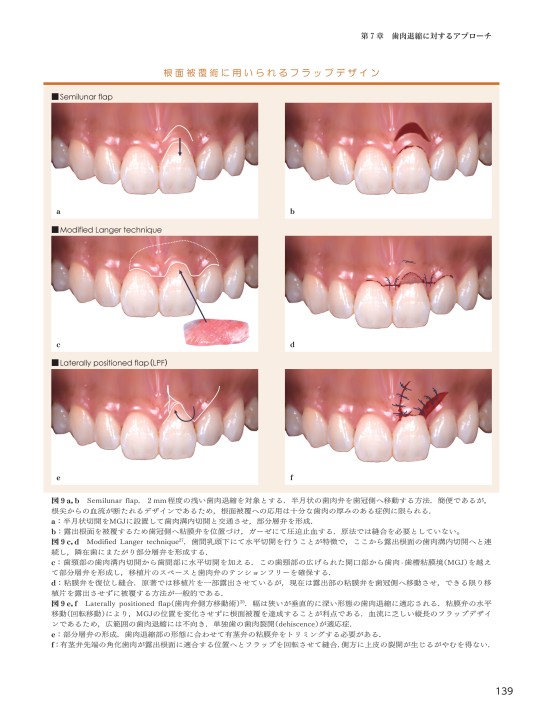 新時代の歯周外科