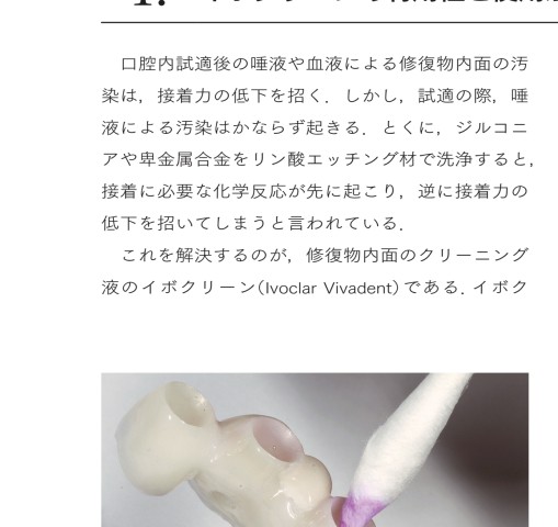 デジタル・モノリシック・インプラントレストレーション