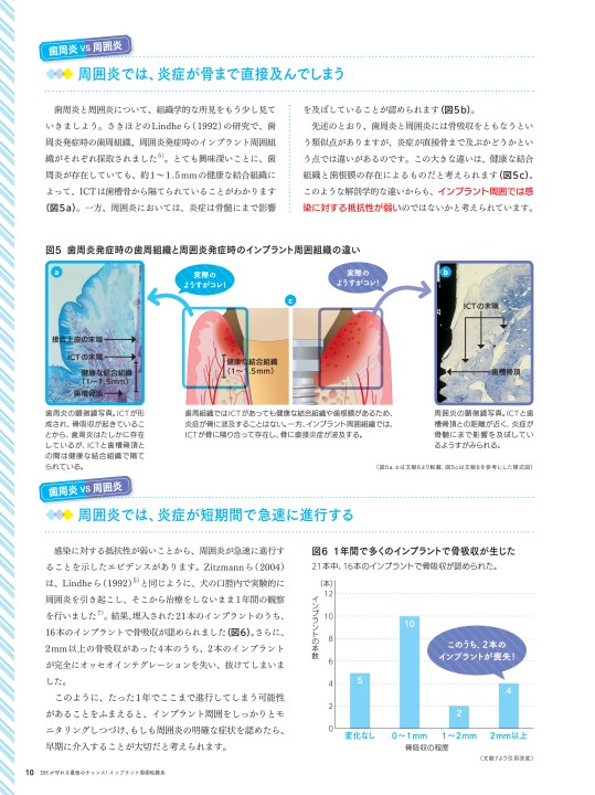 DHが守れる最後のチャンス！インプラント周囲粘膜炎