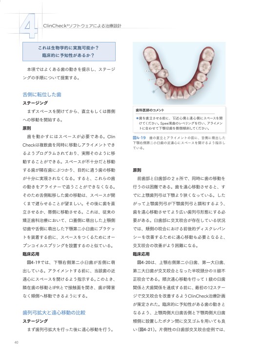 アライナー矯正歯科治療