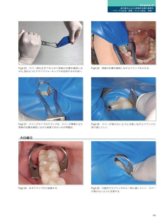 GPのエンド，専門医のエンド