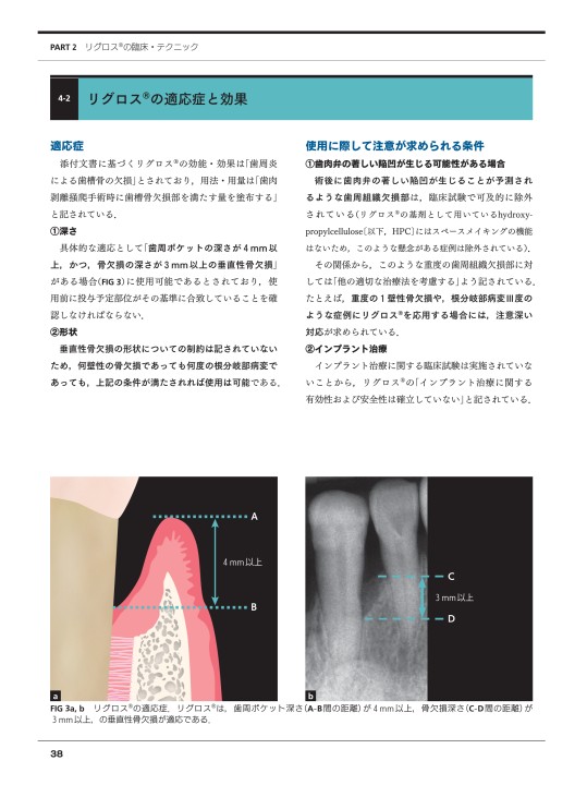 FGF-2と歯周組織再生療法