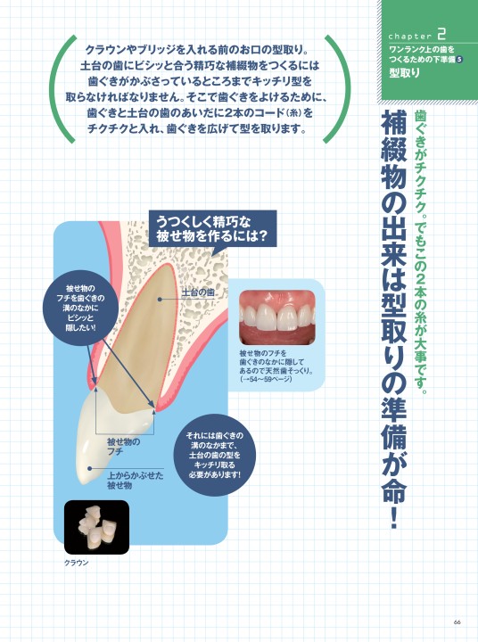 スーパー図解 補綴治療