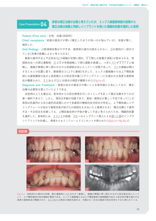 歯列不正・不正咬合の患者が来院したら