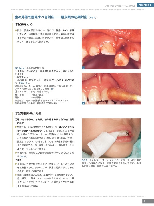 歯の外傷で小児が来院したら 泣いてた親子を笑顔で帰す | 宮新