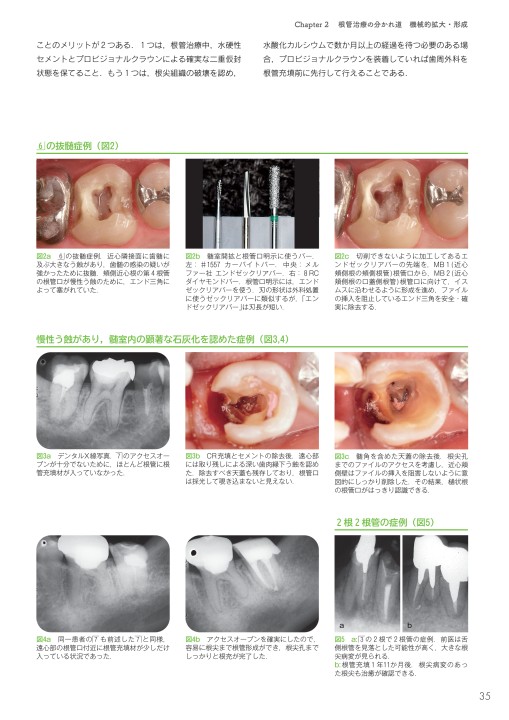 驚くほど臨床が楽しくなる！ こだわりエンドサブノート