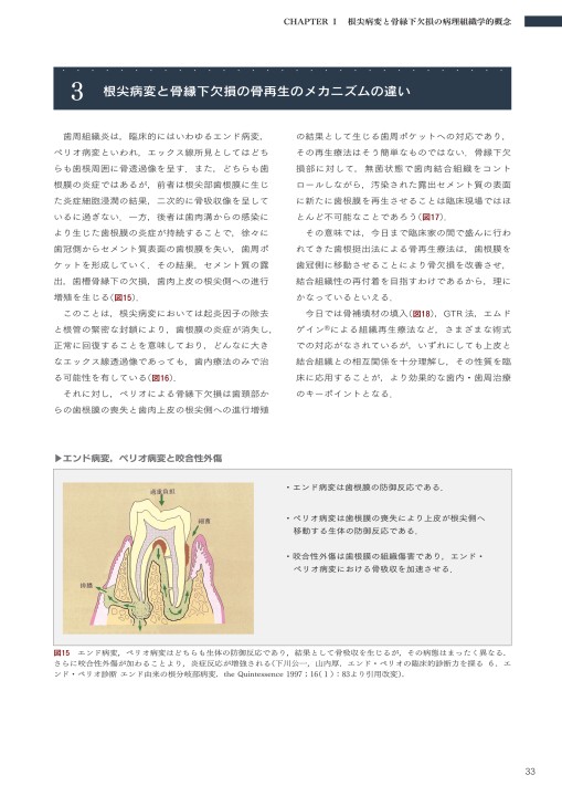 長期経過症例から紐解く根尖病変と骨縁下欠損