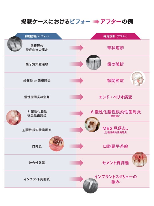 見逃しケースのなぜを解く! 歯科診断スキルアップ実践ガイド 見逃しケースのなぜを解く！ 歯科診断スキルアップ実践ガイド