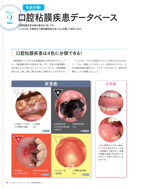 口腔粘膜疾患識別ガイド