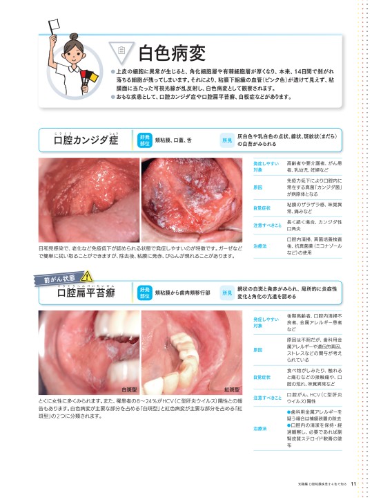 口腔粘膜・皮膚症状から「見抜く」全身疾患 オラドローム、デルマドローム 皮膚症状110症例でみる内科疾患【電子版付】｜書籍・jmedmook