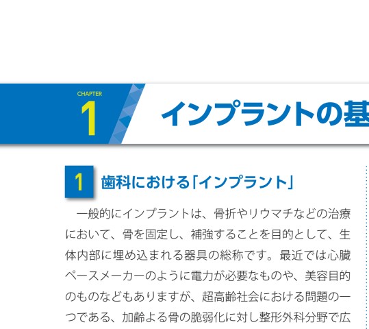 OJのスペシャリストたちがおくる インプラント 基本の「き」 (別冊QDI) OJのスペシャリストたちがおくる インプラント 基本の「き